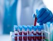 بررسی تست آزمایشگاهی Tetanus Antibody / Tetanus Ab